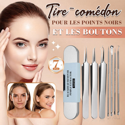 🧴🔍 Kit d’outils pour points noirs et boutons – 4 pièces, embouts de précision et loupe 15x