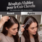 💆🛒️ Peigne Applicateur pour Cuir Chevelu ! 🌿 Outil de Soin Capillaire – Application de Précision, Embouts Roulants & Corps Transparent.